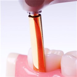 PERIOTOME 3MM SHORT TIP FOR LUX LX