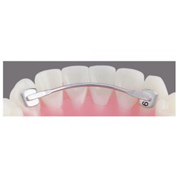 Bondable Lingual Retainer 3-3 No0 30mm 5Pk