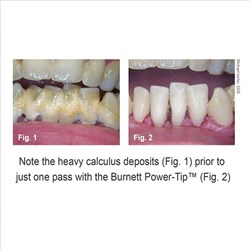 30K BURNETT POWER TIP INTERNAL WATER