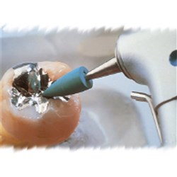 GREENIE POINTS CA MINI POINT