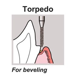 DIAMOND POINT FG REG 212R
